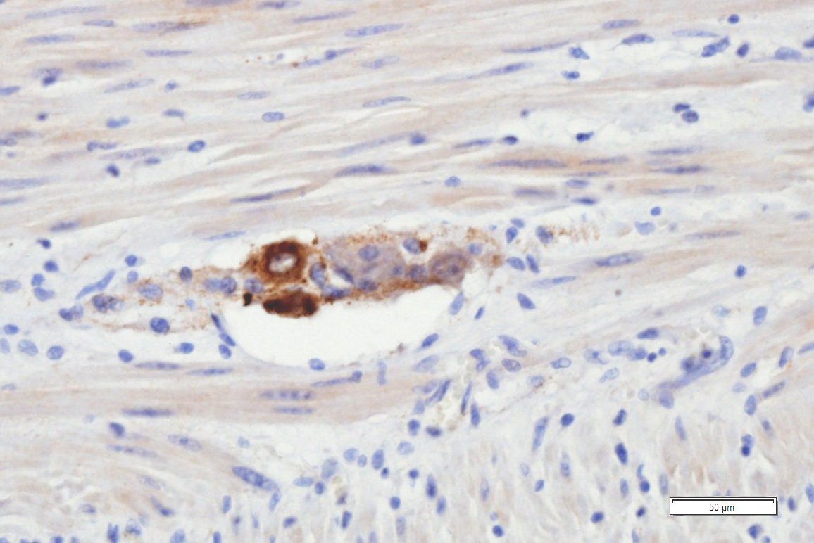 Paraffin Schnitt von Human Ganglien Kolon; Mouse anti-Human Chromogranin A