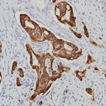 Staining of human Lung with Mouse anti-Human Cytokeratin 20 - Clone Ks 20.8